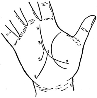 Plate XIII. THE LINE OF DESTINY AND ITS MODIFICATIONS.