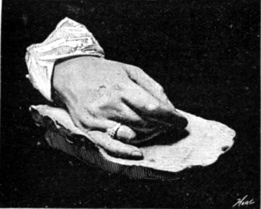 HAND OF ZOE, WIFE OF THE LATE ARCHBISHOP OF YORK.