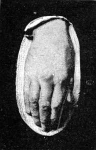 LORD BEACONSFIELD'S HAND.