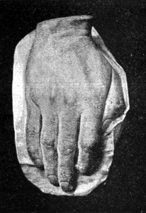SIR BARTLE FRERE'S HAND.
