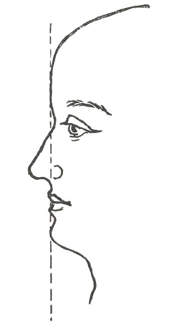 Fig. 20

CHIN STUDY