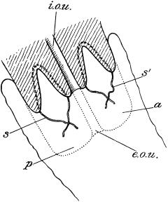 Marckwald’s Operation for
Congenital Hypertrophy of the Cervix