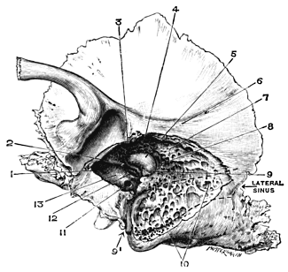 Left Temporal Bone, showing Anatomy of the Middle Ear and Mastoid Process