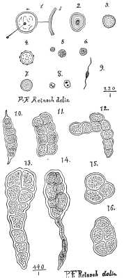 PLATE X.--EXPLANATION OF FIGURES.--1, Spore with thick laminated covering, constant colorless contents, and dark nucleus. B, Part of the wall of cell highly magnified, 0.022 millimeter in thickness. 2, Smaller spore with verruculous covering. 3, Spore with punctulated covering. 4, The same. 5, Minute spores with blue-greenish colored contents, 0.0021 millimeter in diameter. 6, Larger form of 5. 7, Transparent spherical spore, contents distinctly refracting the light, 0.022 millimeter in diameter. 8, Chroococcoid minute cells, with transparent, colorless covering, 0.0041 millimeter in diameter. 9, Biciliated zoospore. 10, Plant of the Gemiasma rubra, thallus on both ends attenuated, composed of seven cells of unequal size. 11, Another complete plant of rectangular shape composed of regularly attached cells. 12, Another complete, irregularly shaped and arranged plant. 13, Another plant, one end with incrassated and regularly arranged cells. 14, Another elliptical shaped plant, the covering on one end attenuated into a long appendix. 15, Three celled plant. 16, Five celled plant. 10-16 magnified 440/1.